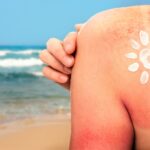 Sun Exposure and Skin Cancer Prevention