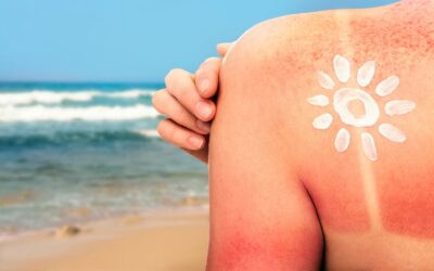 Sun Exposure and Skin Cancer Prevention