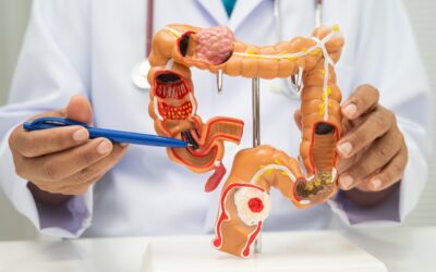 Colorectal Cancer Screening Explained