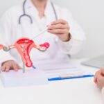Fertility Considerations After Cancer Treatment