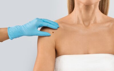 Difference Between Benign and Malignant Tumors