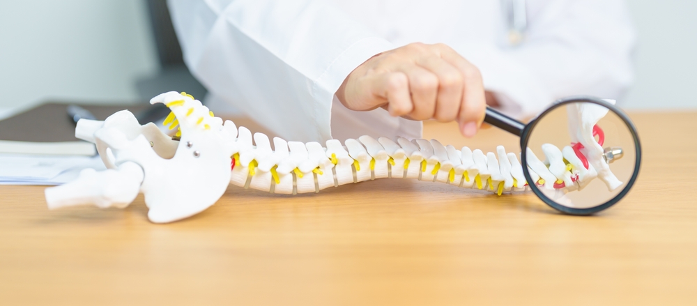 Doctor With Human Spine Anatomy Model. Spinal Cord Disorder And