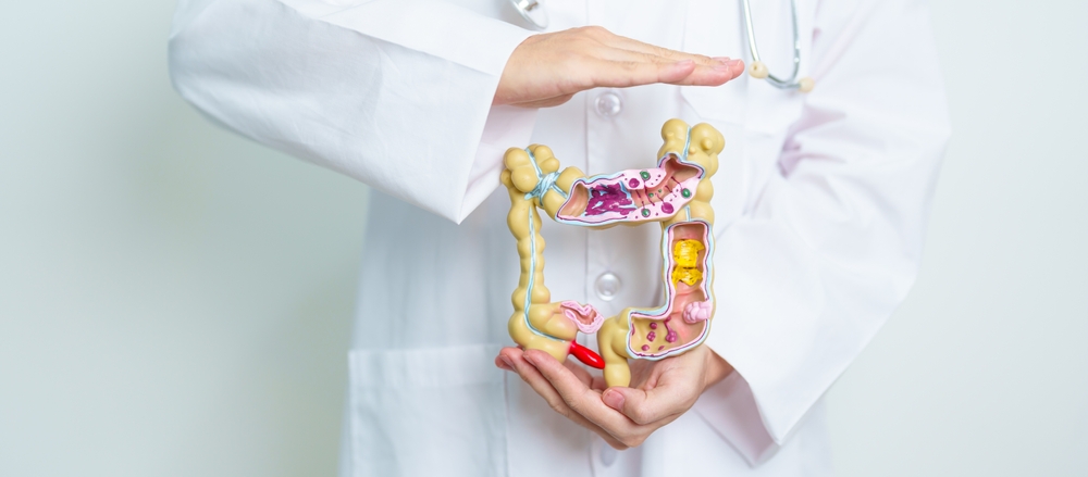 Doctor With Human Colon Anatomy Model. Colonic Disease Large Intestine