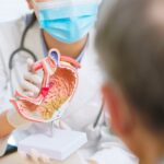 Stomach / Gastric Cancer: Symptoms, Causes, Stages & Treatment