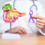 Gallbladder Cancer: Symptoms, Causes, Stages & Treatment