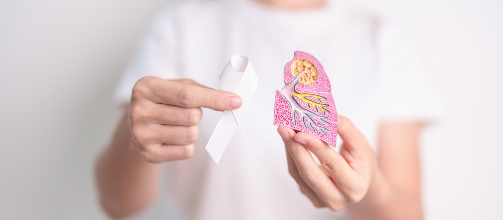 November Lung Cancer Awareness Month. Doctor With Smoker Lung Anatomy