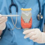 Lymphoma (Hodgkin & Non-Hodgkin): Symptoms, Causes, Stages & Treatment