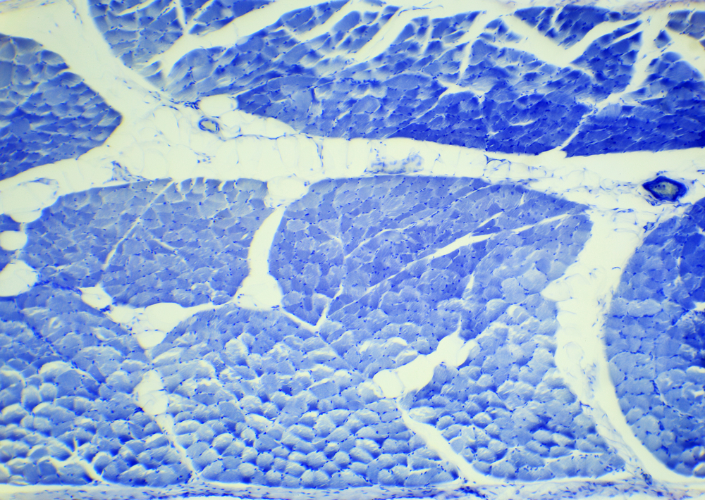 Smooth Muscle Teased Preparation Under A Microscope Smooth Muscle W.m.
